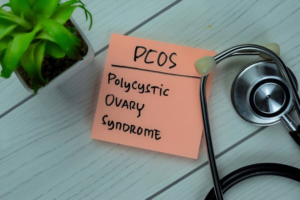 ovaries with PCOS illustration
